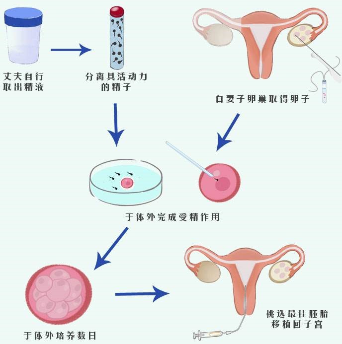 衡阳第三代赠卵试管婴儿医院